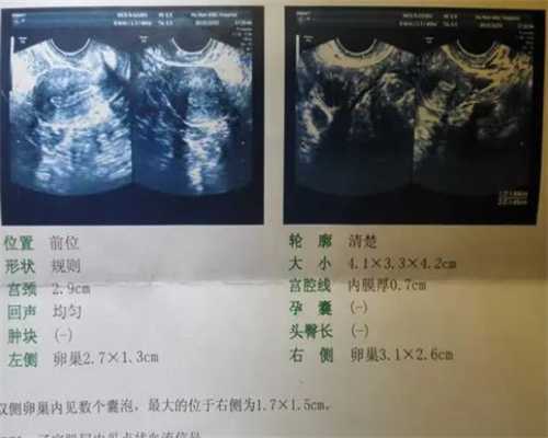 贵阳代孕网公司多吗,
中国试管婴儿当妈,助力推进中国试管行业-得过宫外孕,有